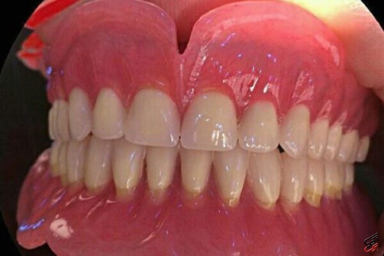 دندان متحرک