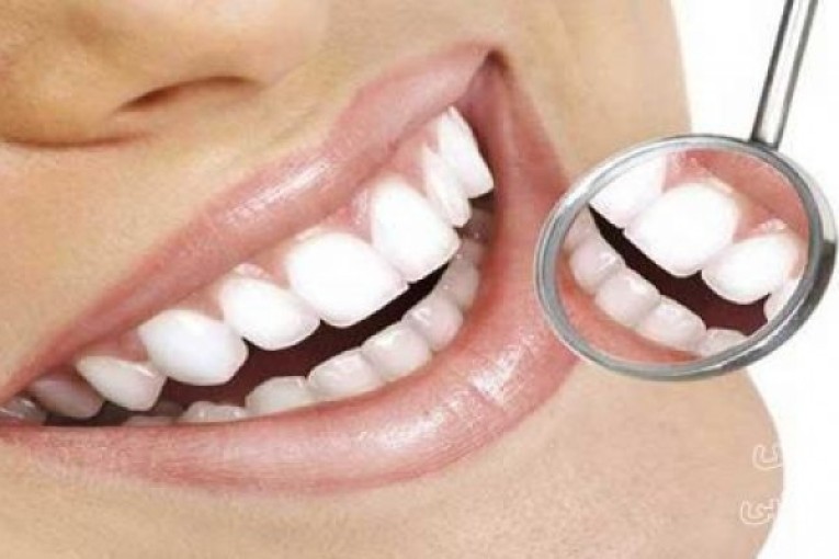کلیه خدمات ایمپلنت دندان