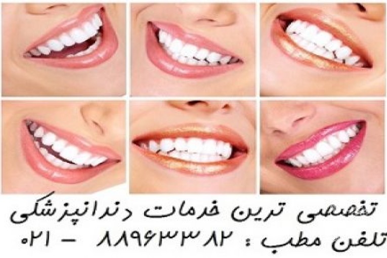 بهترین دندانپزشکی در تهران بهترین متخصص لمینیت در تهران